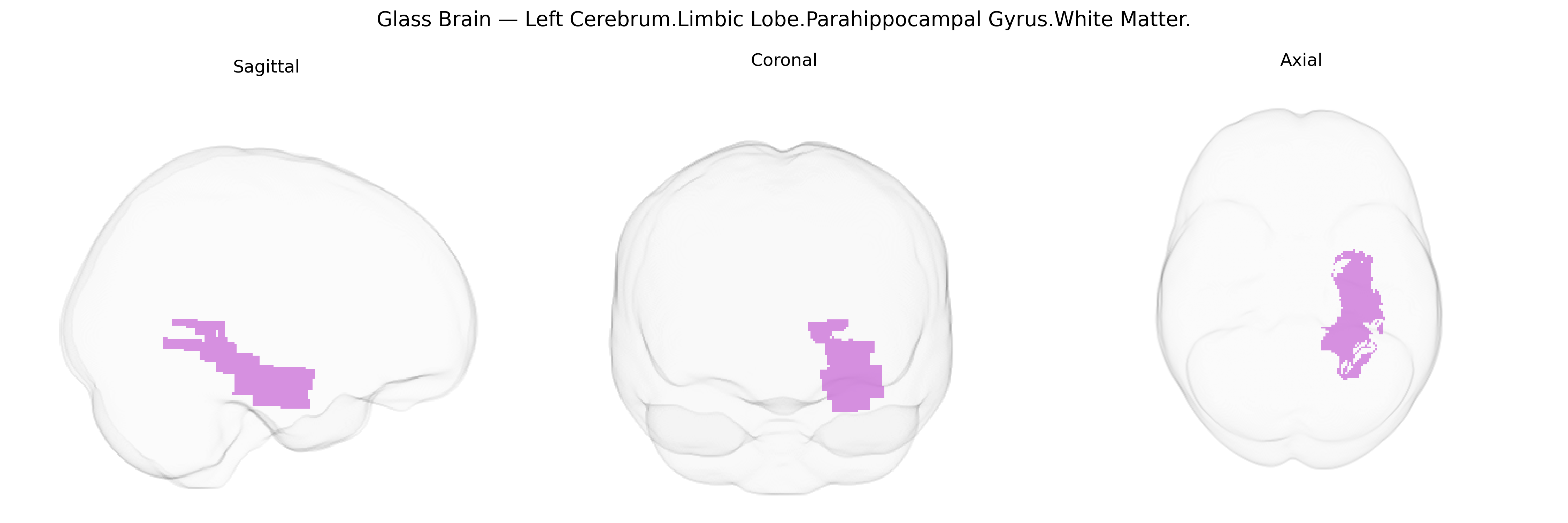 Triplanar Ghost Brain