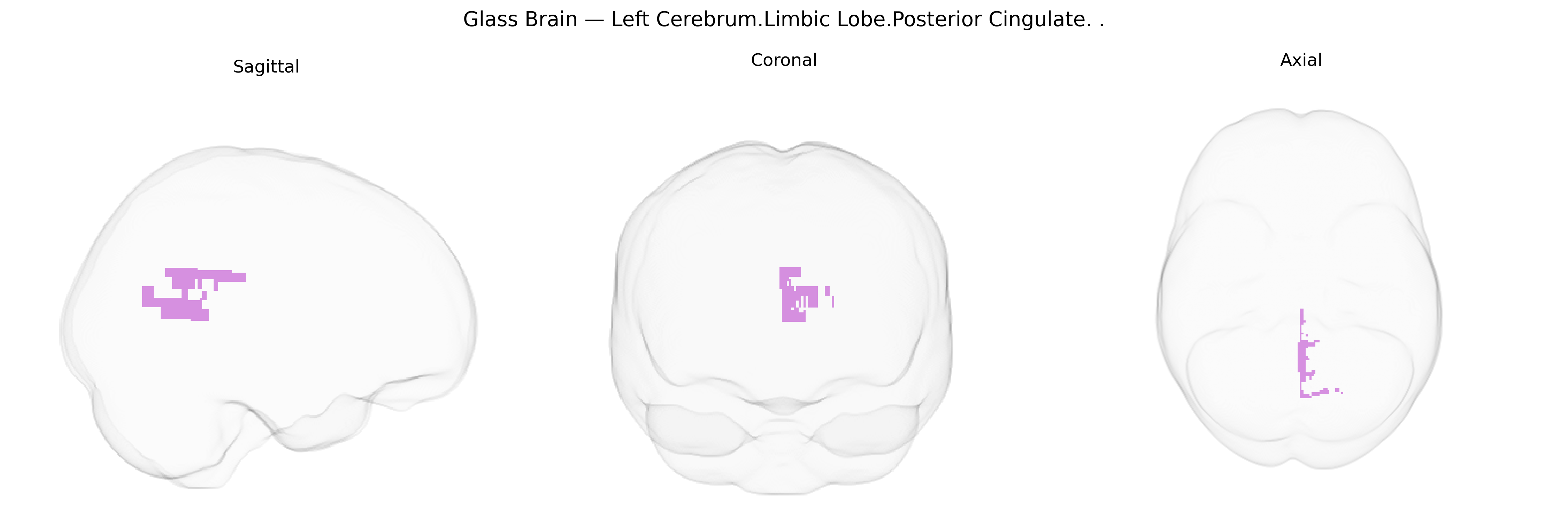 Triplanar Ghost Brain