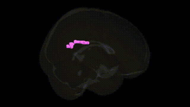 Full Brain Black