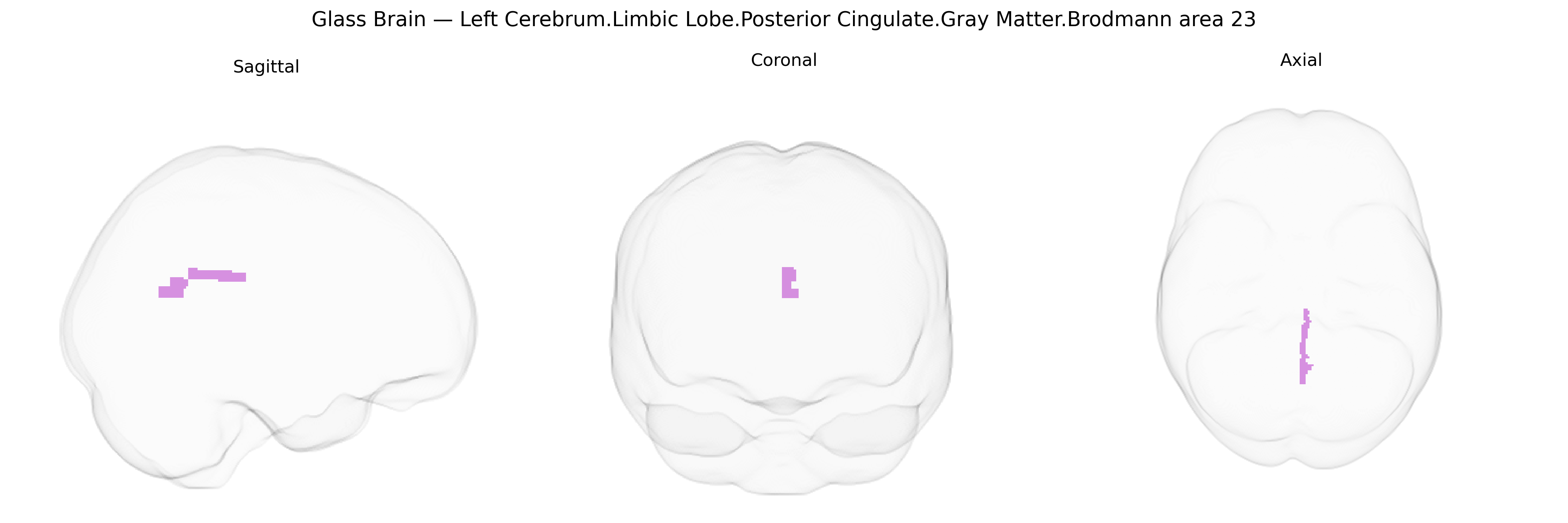 Triplanar Ghost Brain