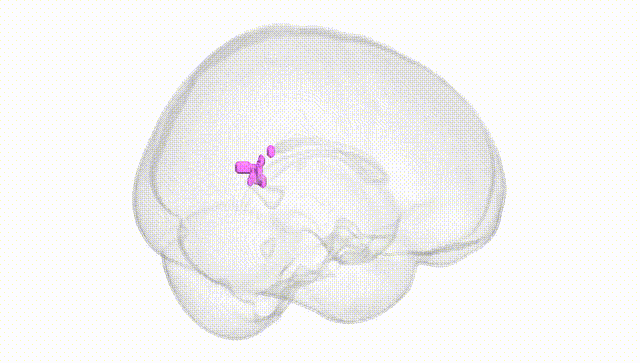 Full Brain White