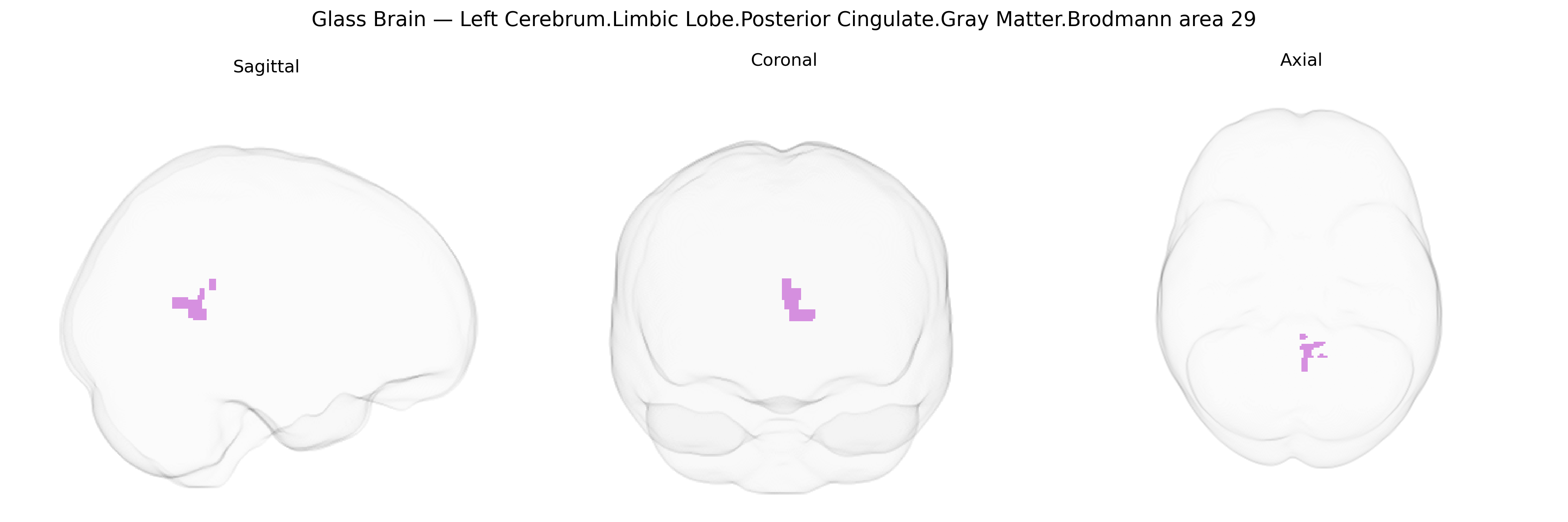 Triplanar Ghost Brain