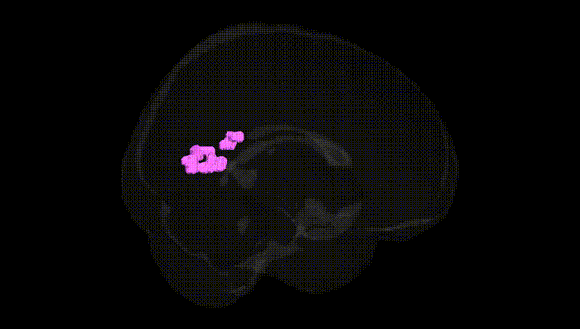 Full Brain Black