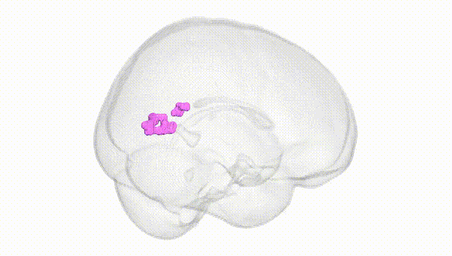 Full Brain White