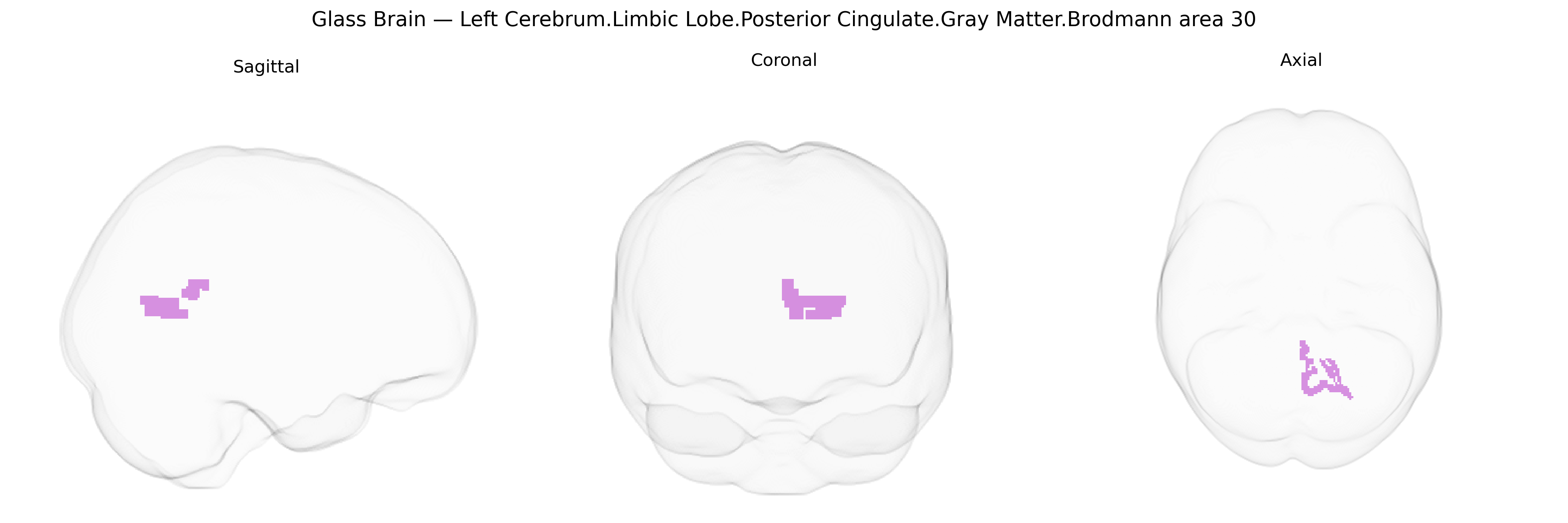 Triplanar Ghost Brain