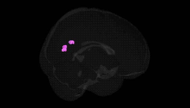 Full Brain Black