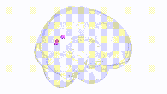 Full Brain White