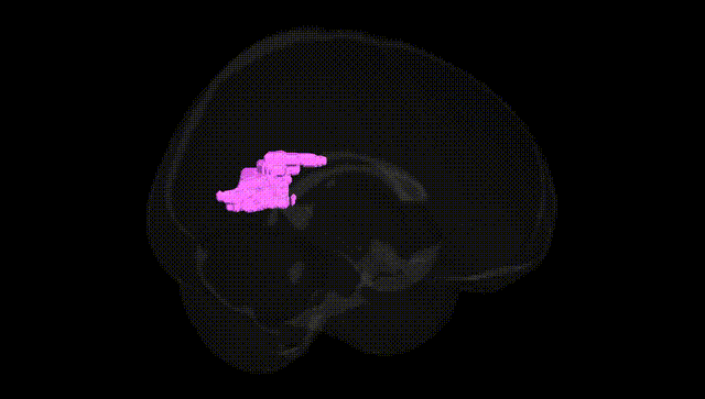 Full Brain Black