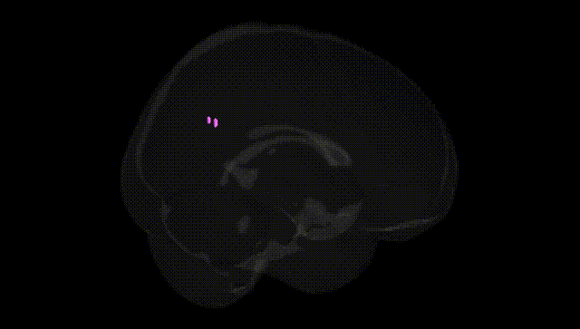 Full Brain Black