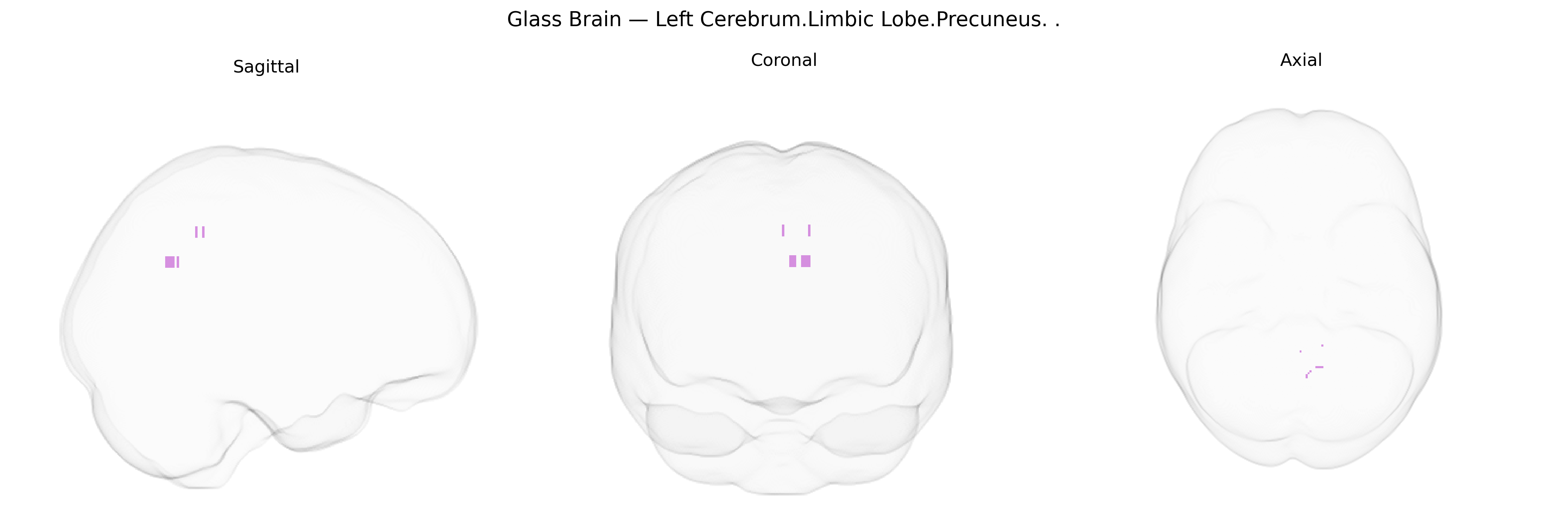 Triplanar Ghost Brain