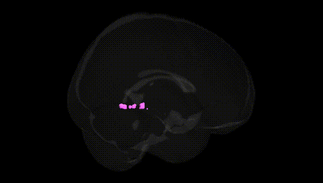 Full Brain Black