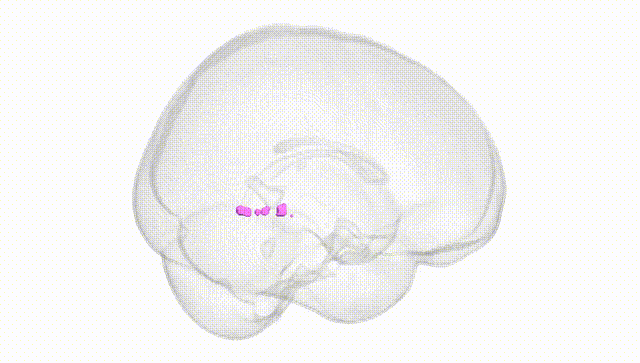 Full Brain White