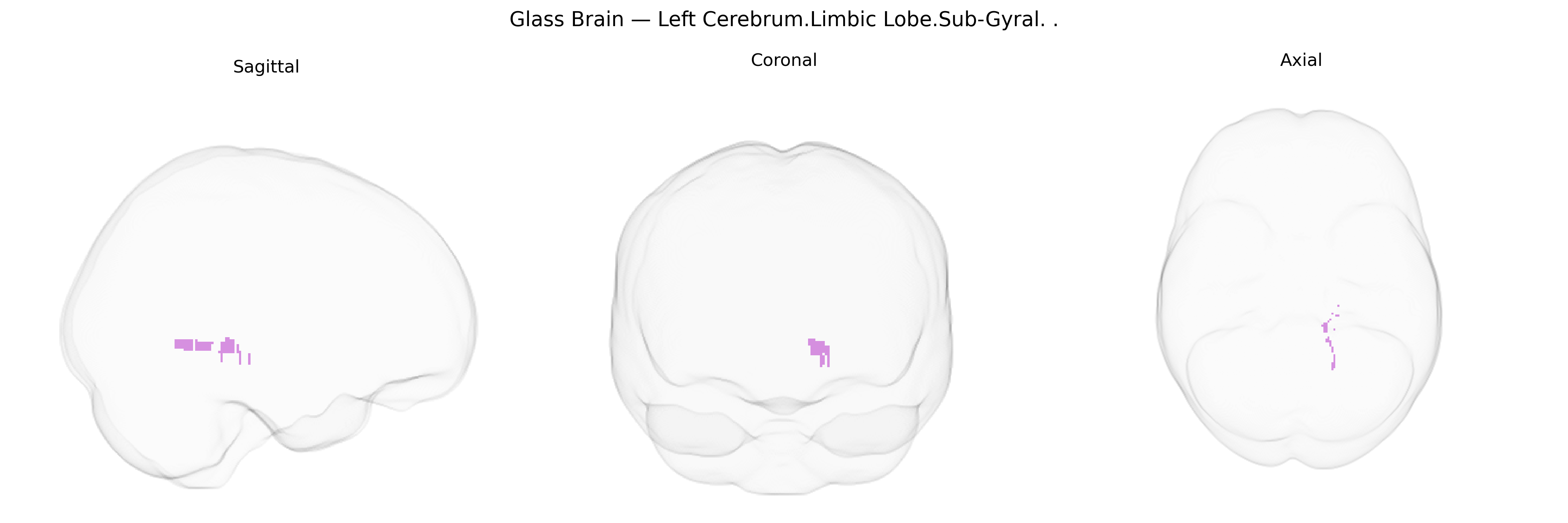 Triplanar Ghost Brain