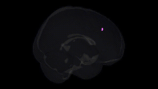 Full Brain Black