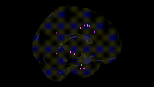 Full Brain Black