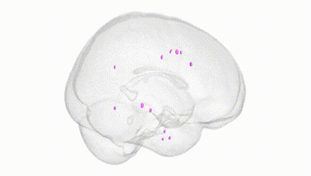 Full Brain White