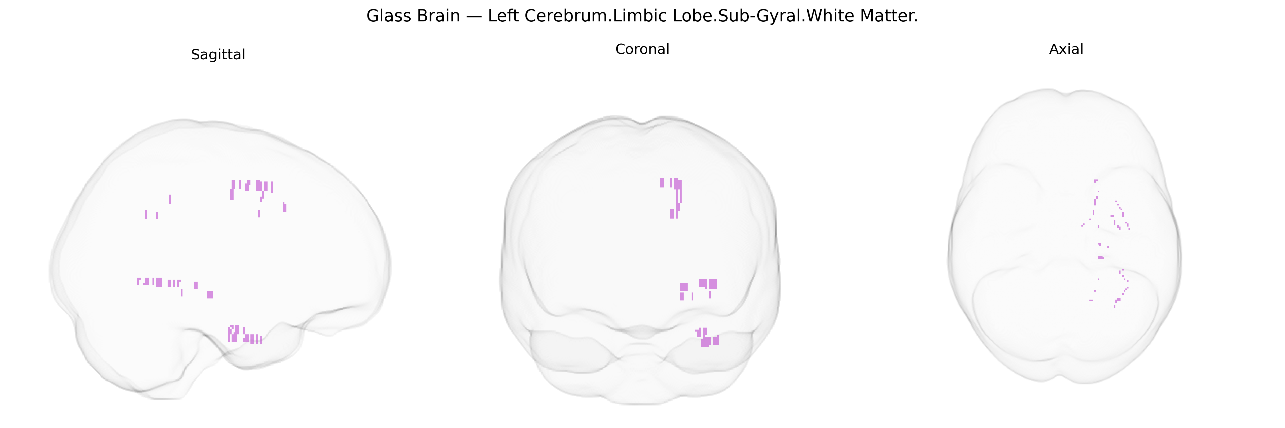 Triplanar Ghost Brain