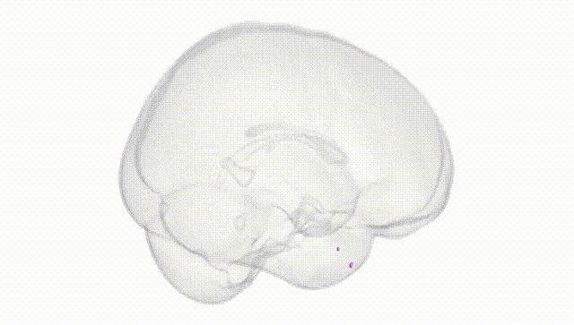 Full Brain White