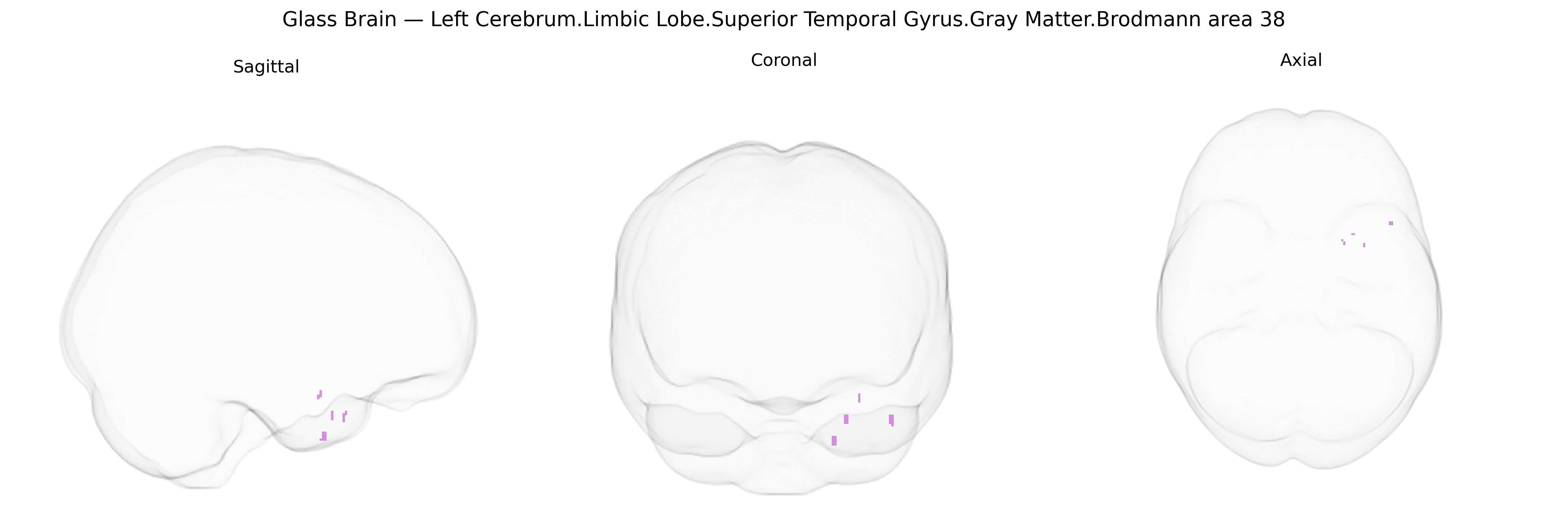 Triplanar Ghost Brain