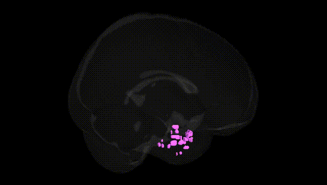 Full Brain Black