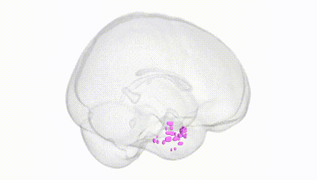 Full Brain White