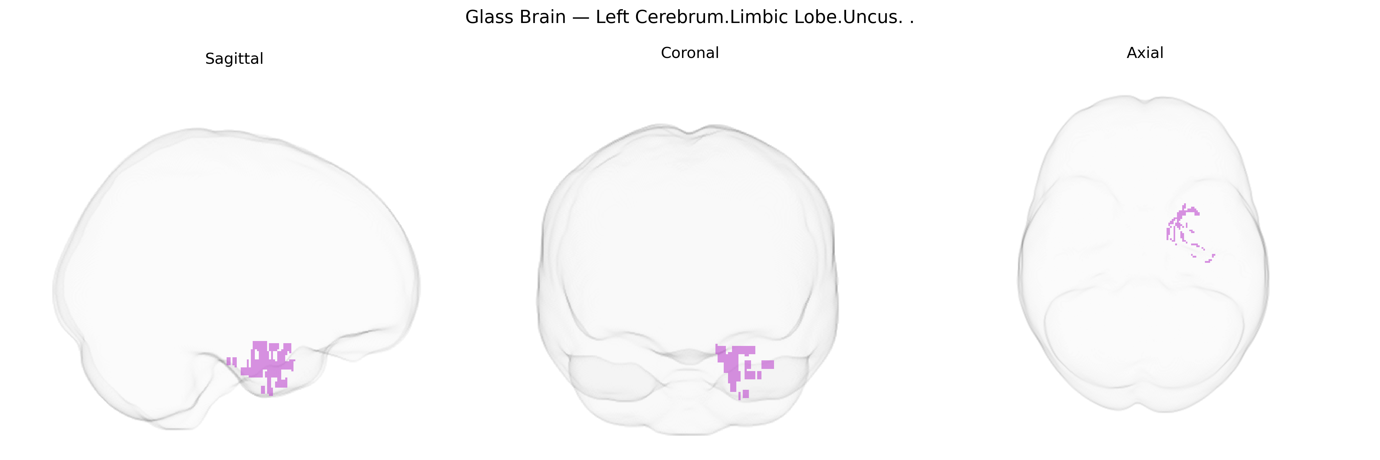 Triplanar Ghost Brain