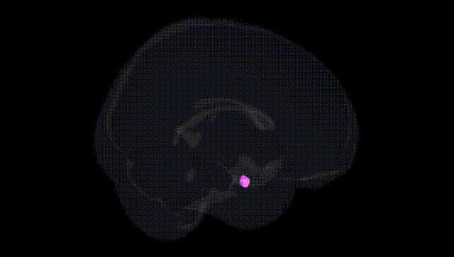 Full Brain Black