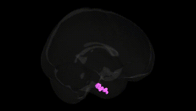 Full Brain Black