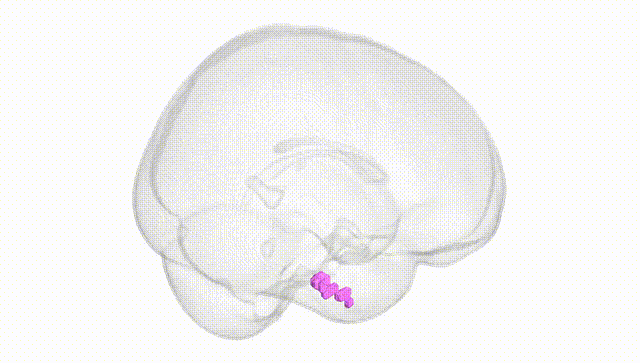 Full Brain White