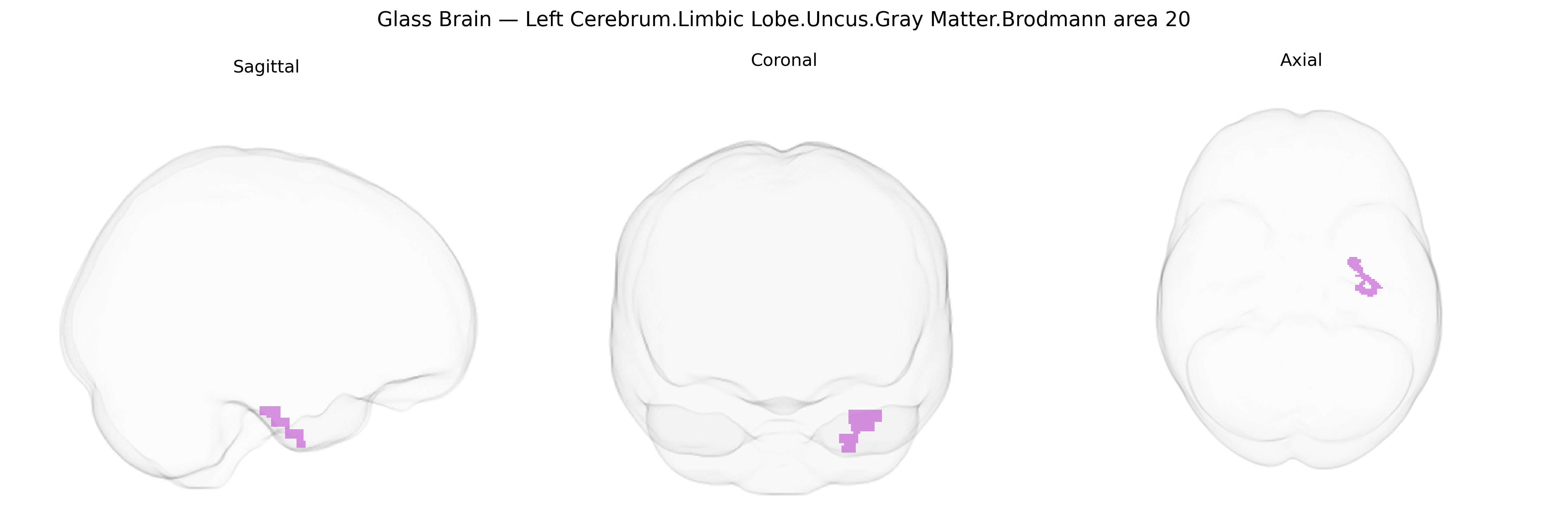 Triplanar Ghost Brain