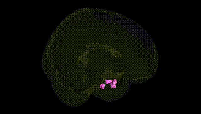 Full Brain Black