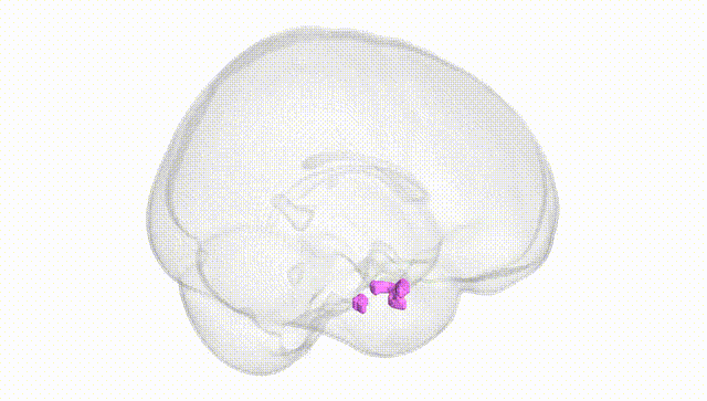 Full Brain White