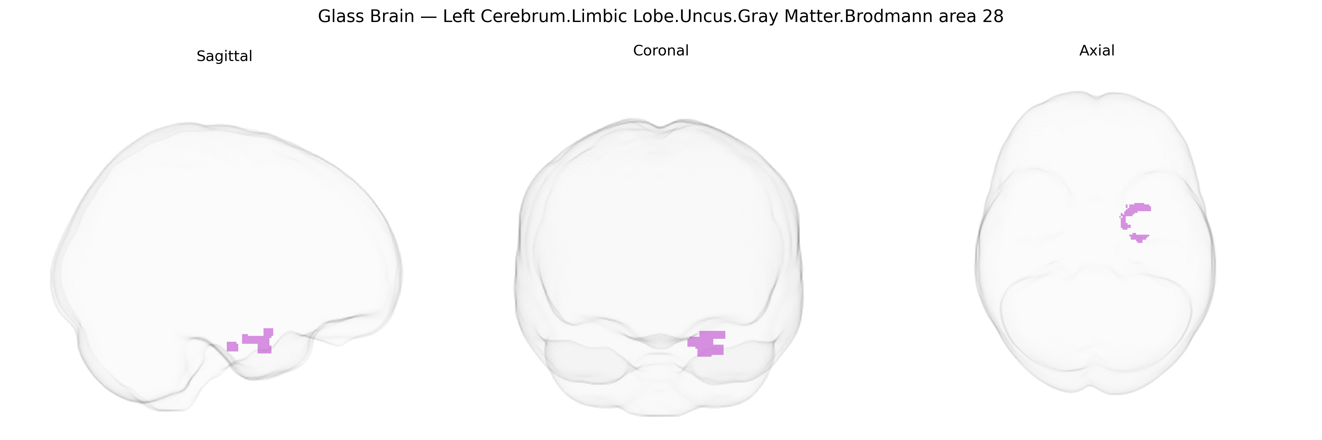 Triplanar Ghost Brain