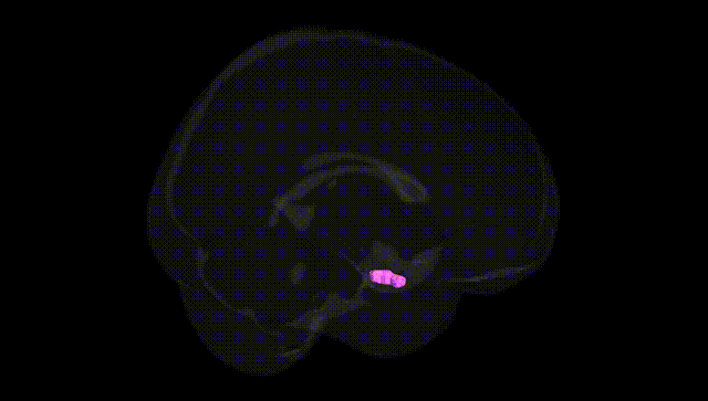 Full Brain Black