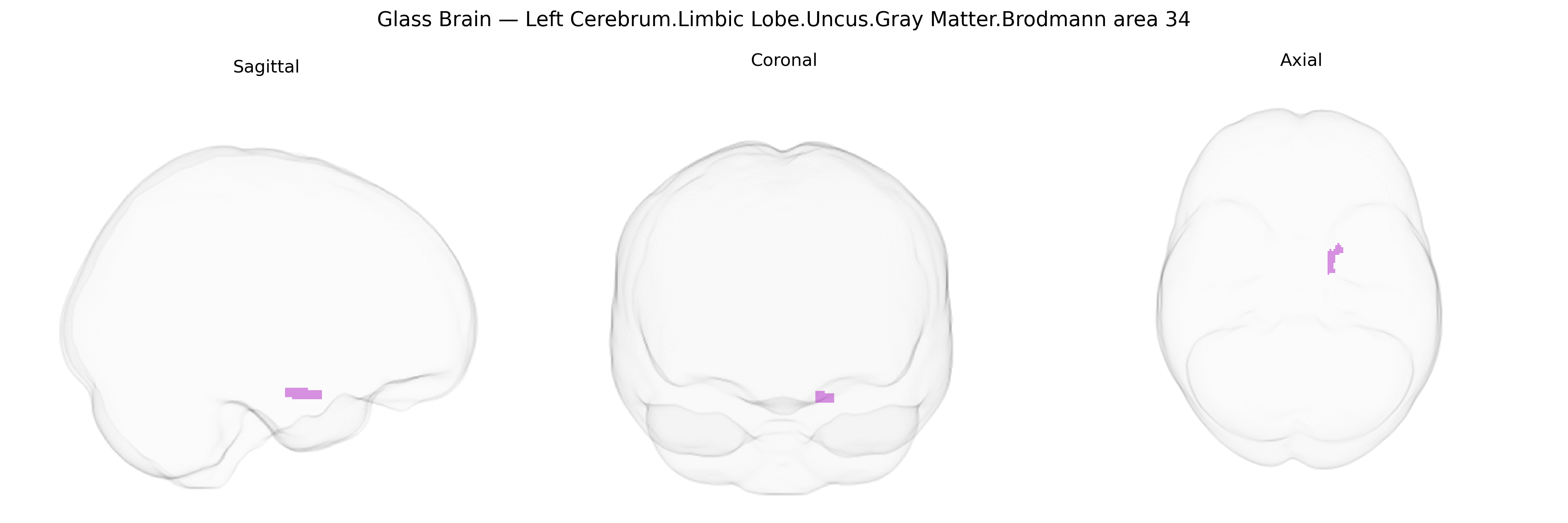 Triplanar Ghost Brain