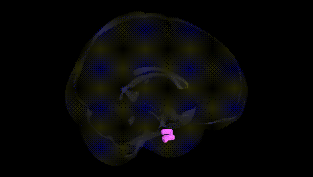 Full Brain Black
