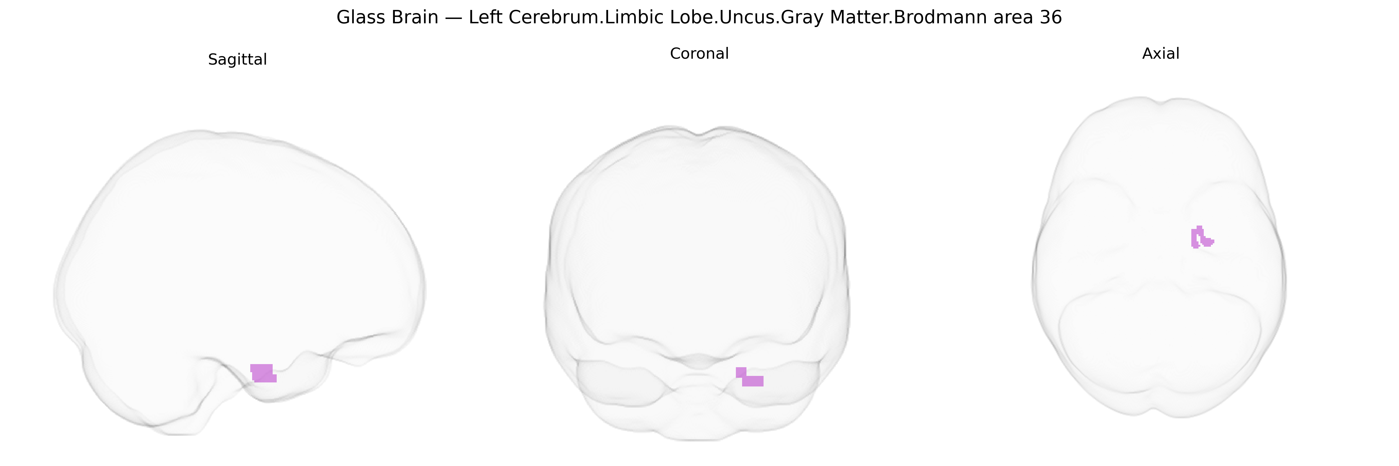 Triplanar Ghost Brain