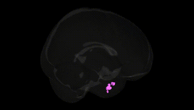 Full Brain Black