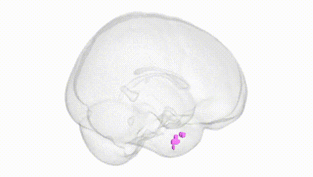 Full Brain White