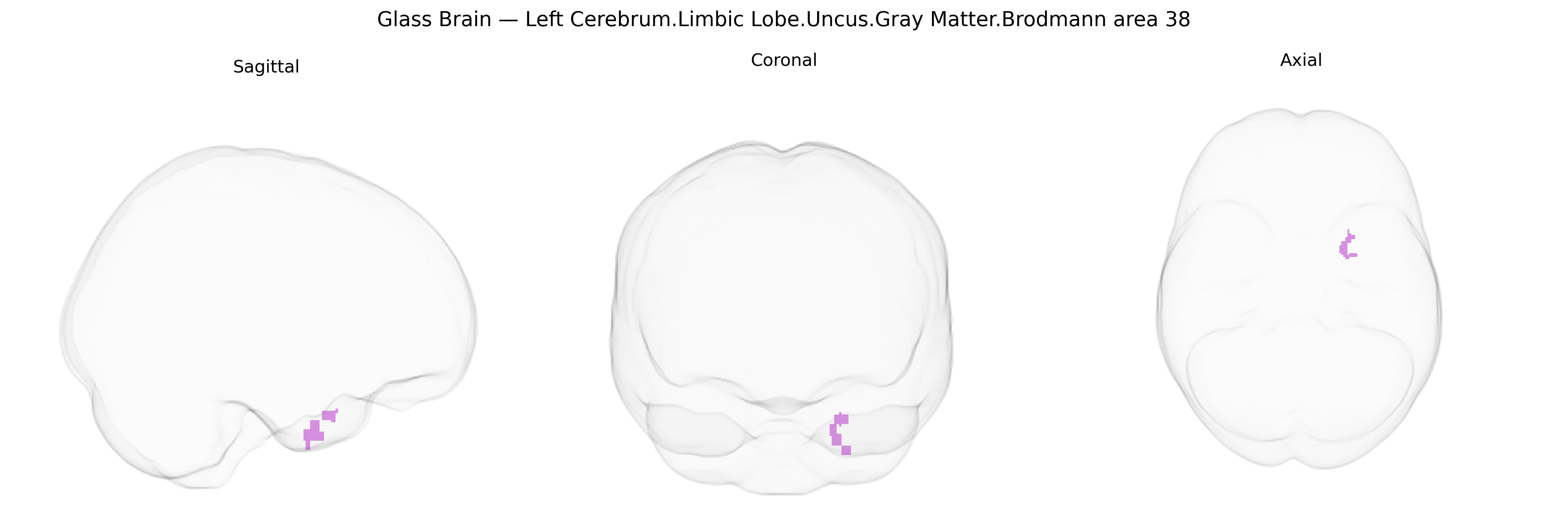 Triplanar Ghost Brain
