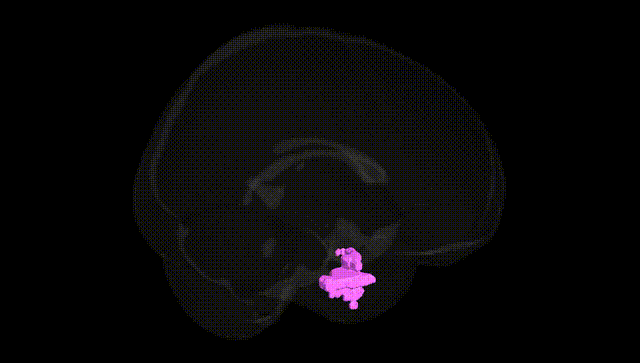 Full Brain Black