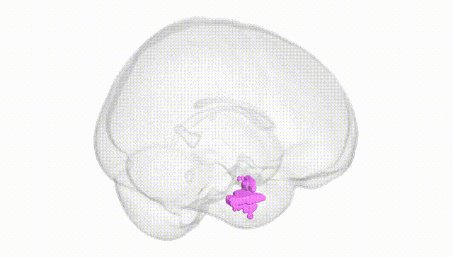 Full Brain White