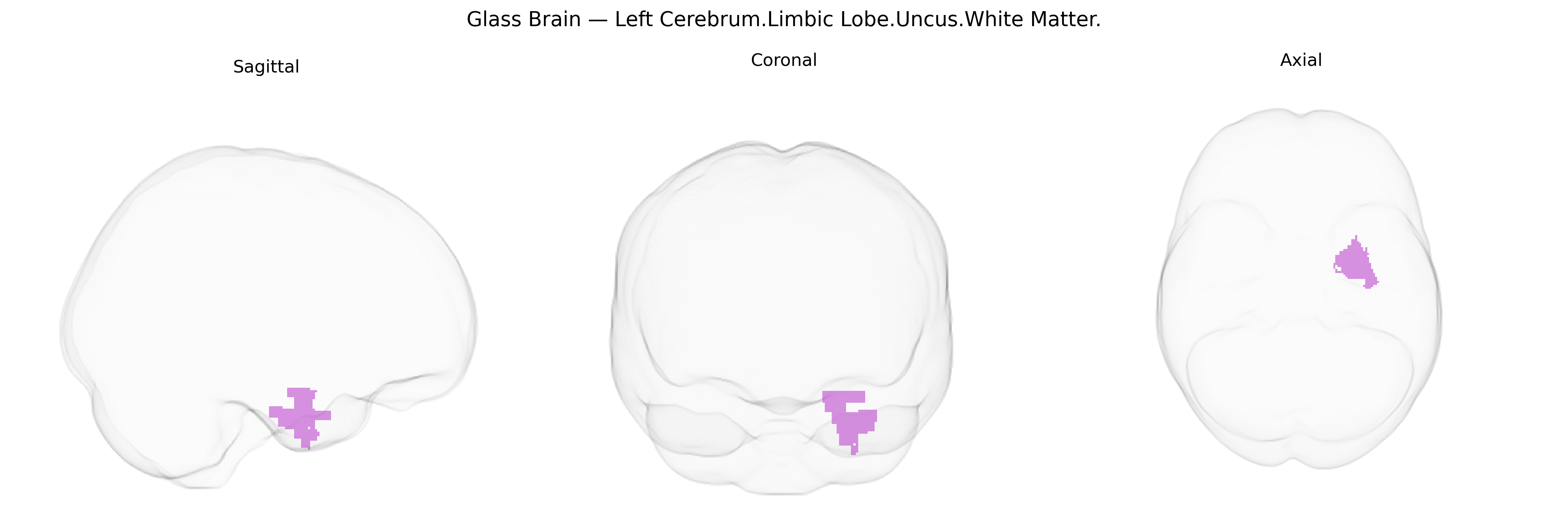 Triplanar Ghost Brain