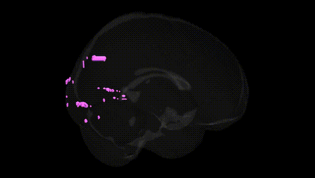 Full Brain Black