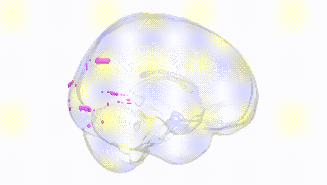 Full Brain White