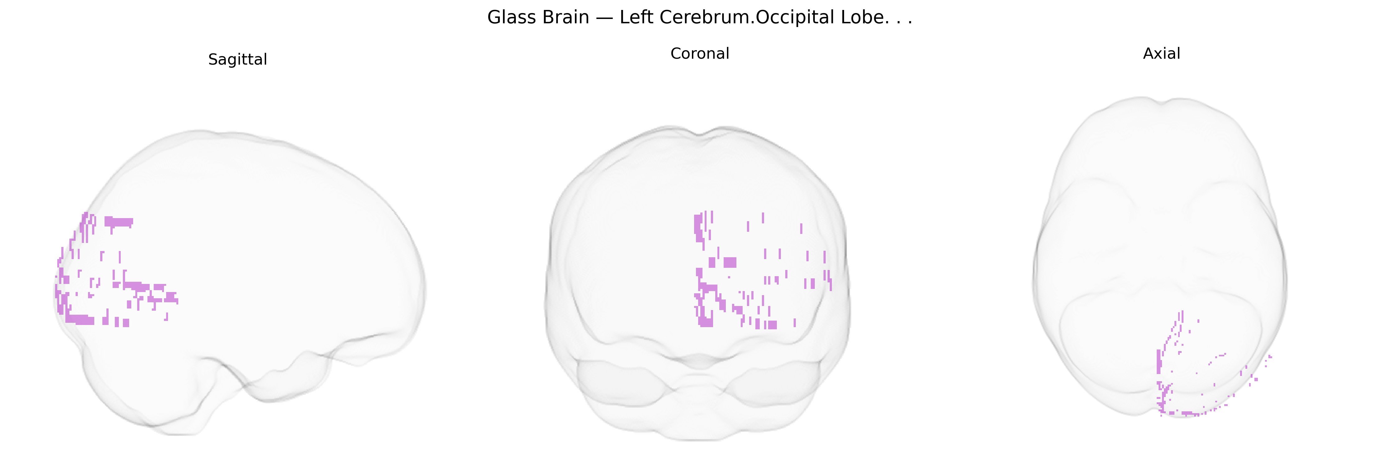 Triplanar Ghost Brain