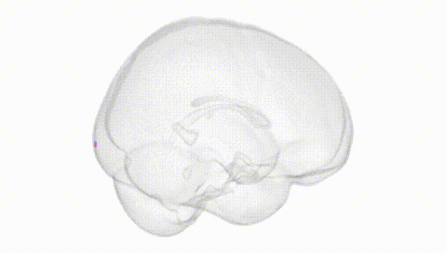 Full Brain White