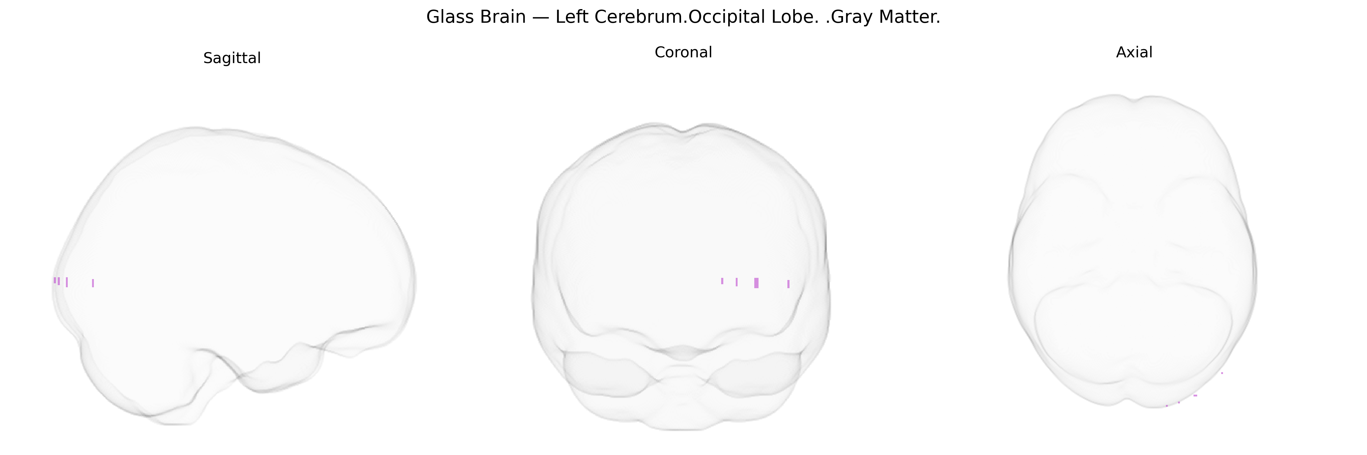 Triplanar Ghost Brain