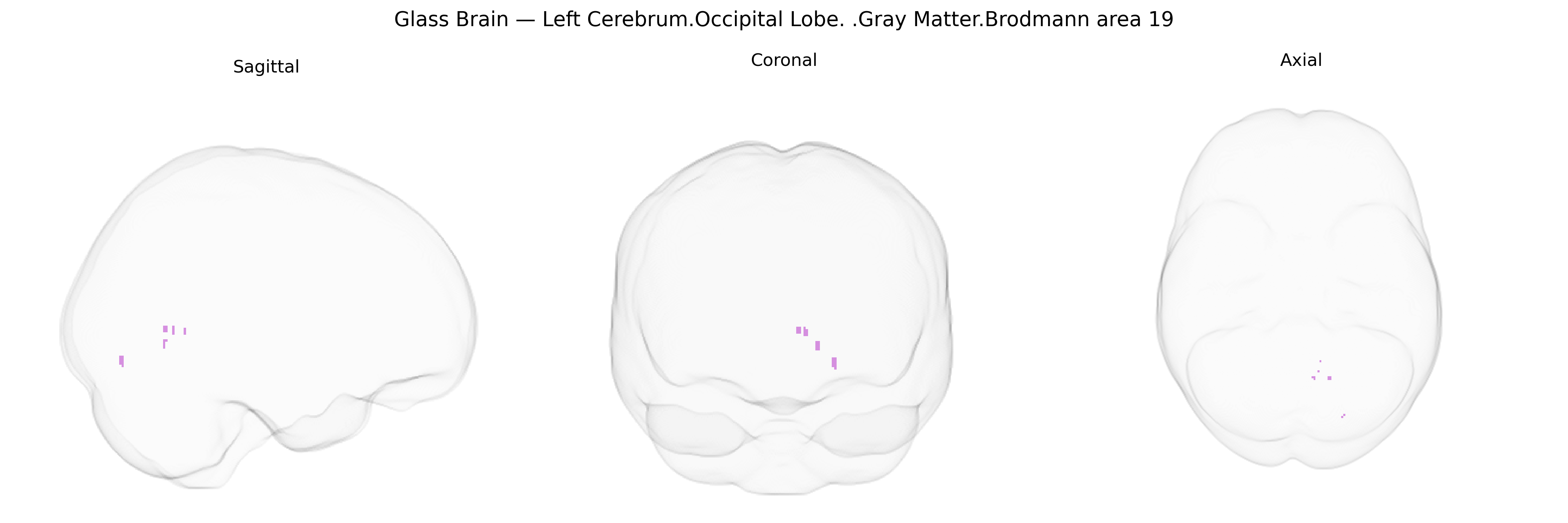 Triplanar Ghost Brain