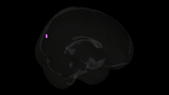 Full Brain Black